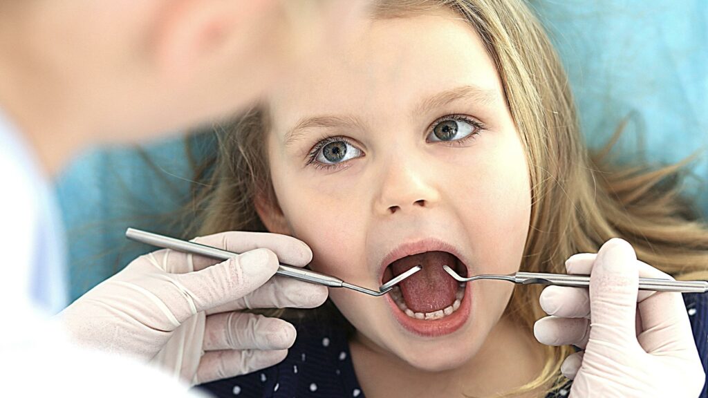 Včasná návštěva zubaře pomůže odhalit zubní kaz na mléčném zubu.