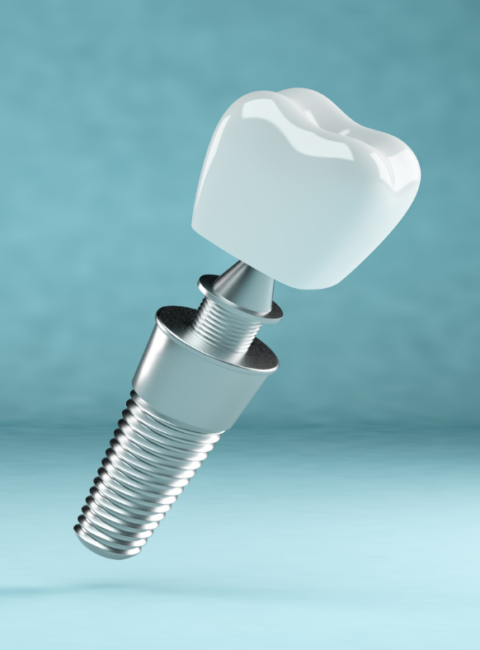zubní implantáty